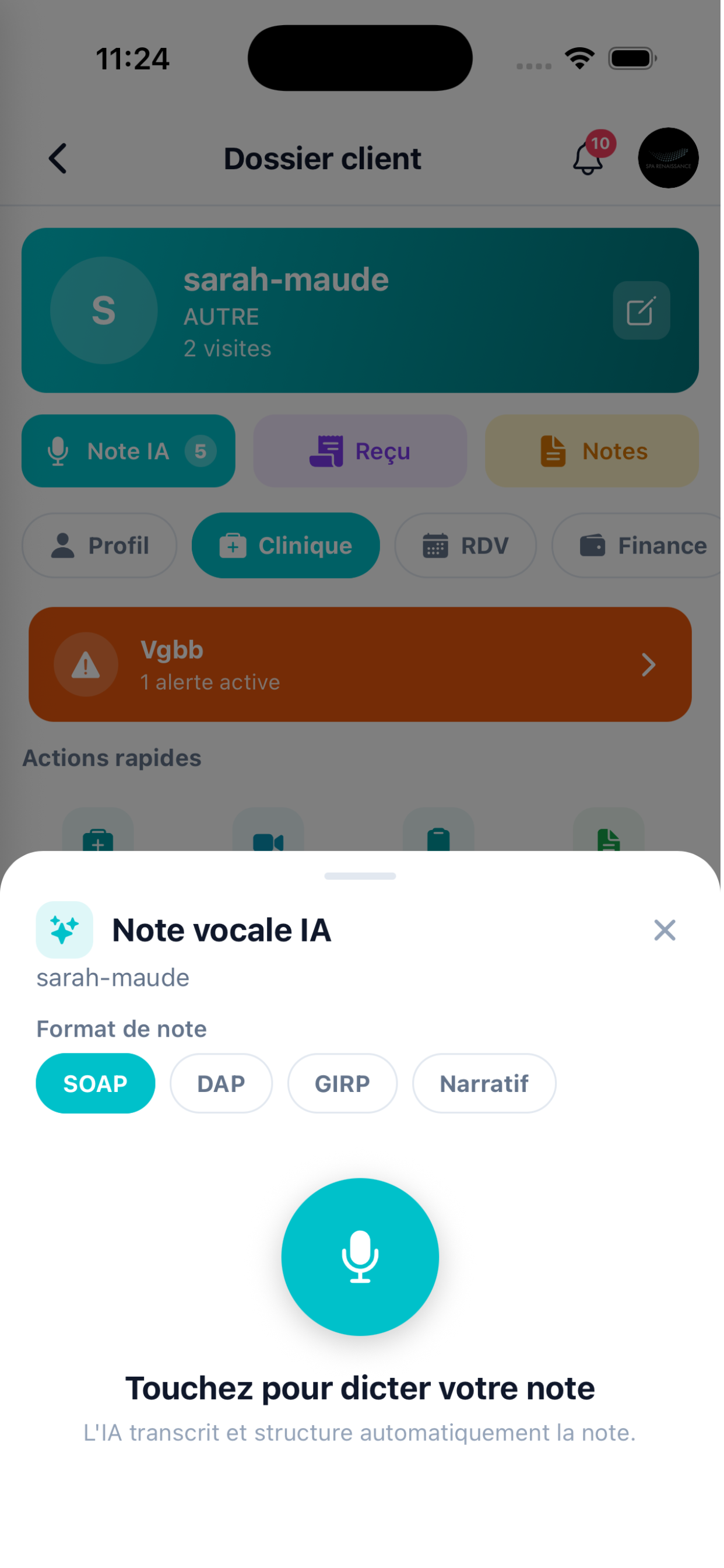 Note vocale IA